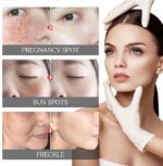 Eelhoe - Pigment Correcting Cream - Image 5