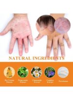 South Moon - Bee Venom Psoriasis Care Cream