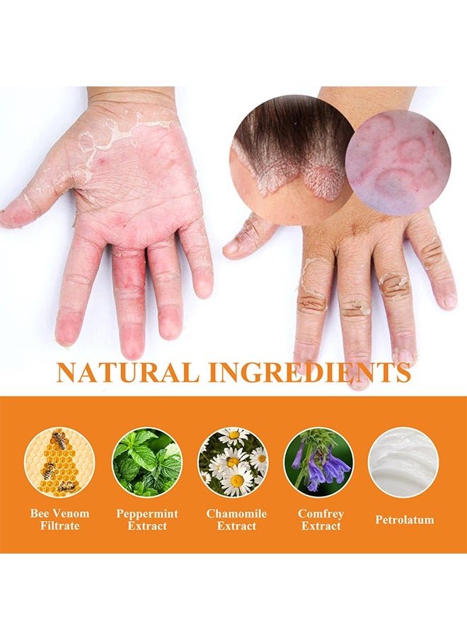 South Moon - Bee Venom Psoriasis Care Cream-9 (1) South Moon - Bee Venom Psoriasis Care Cream - Image 1