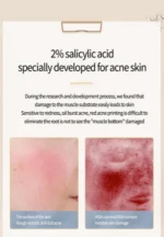 Acne Removing Salicylate Products - Image 3