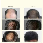 Ginger Anti-hair Loss Hair Maintenance 30ml - Image 4